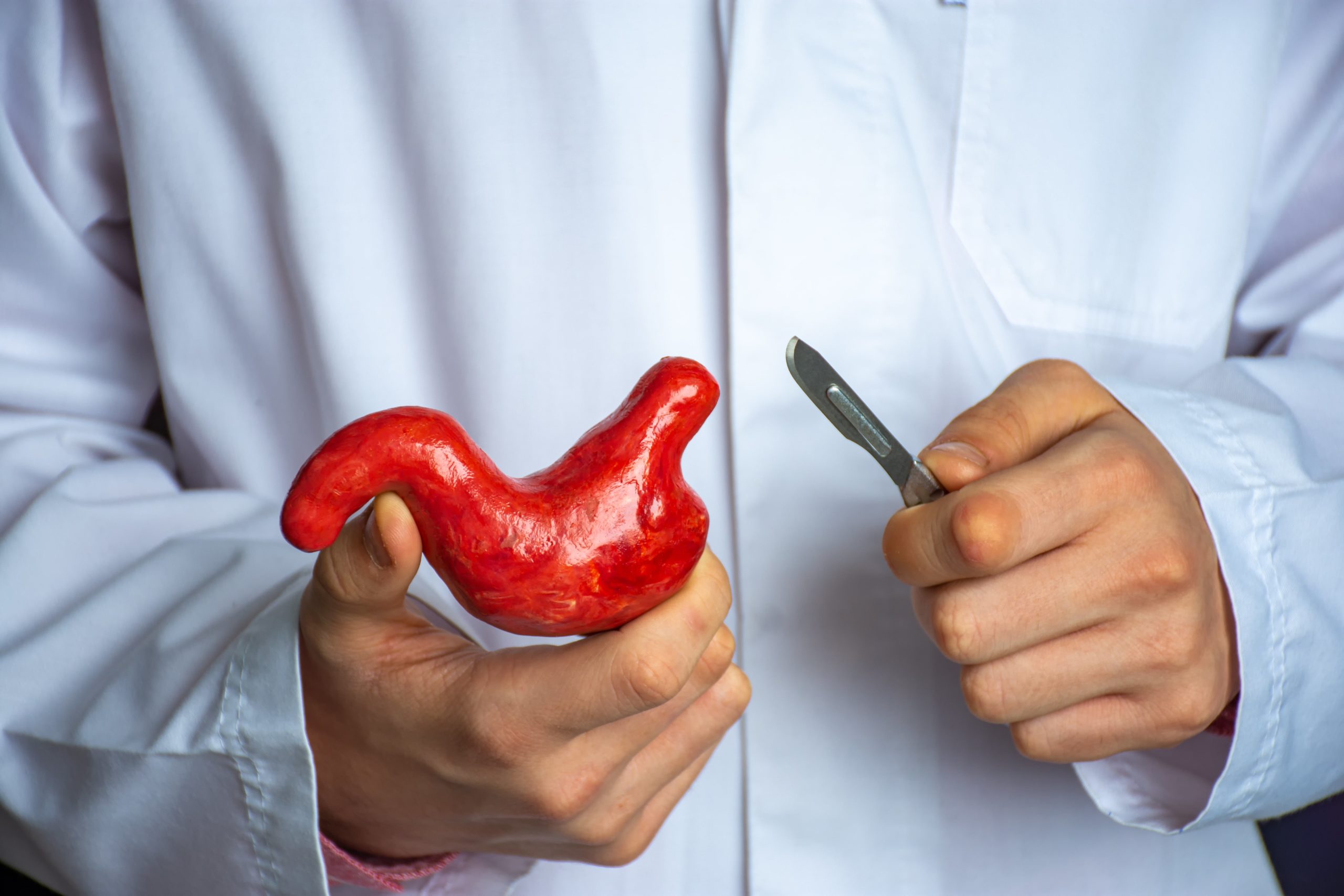 Cirurgia bariátrica