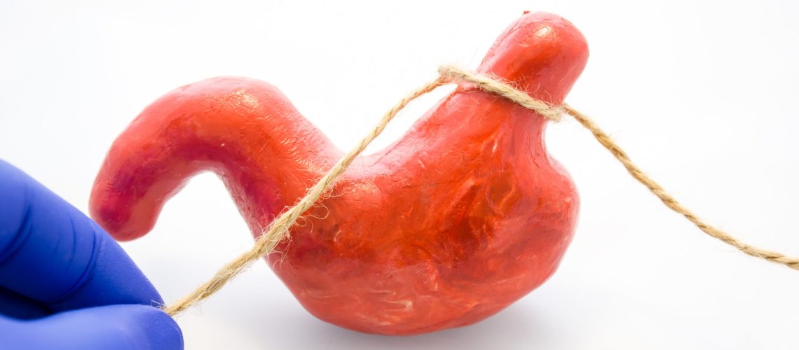 Cirurgia bariátrica