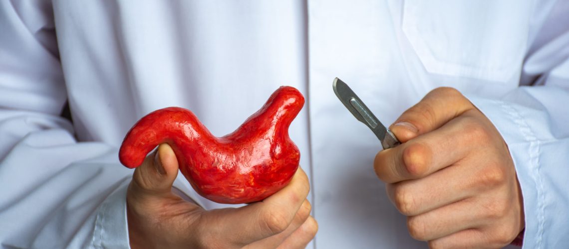 Cirurgia bariátrica