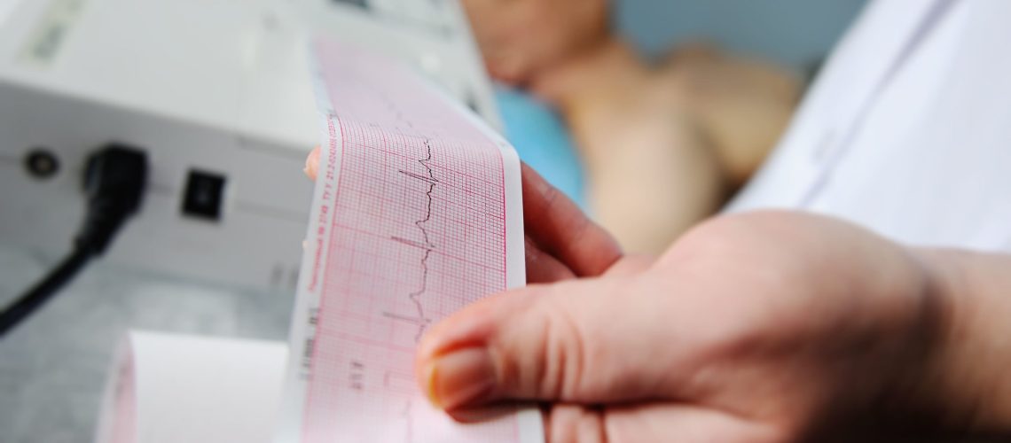 adobestock-139996144-scaled