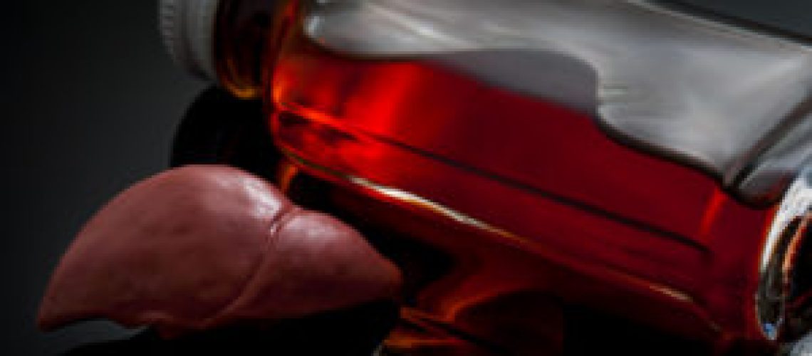 Alcoholic liver damage and cirrhosis concept with a liver next to a flask of alcohol. Cirrhosis is most commonly caused by alcoholism, hepatitis B or C or non-alcoholic fatty liver disease